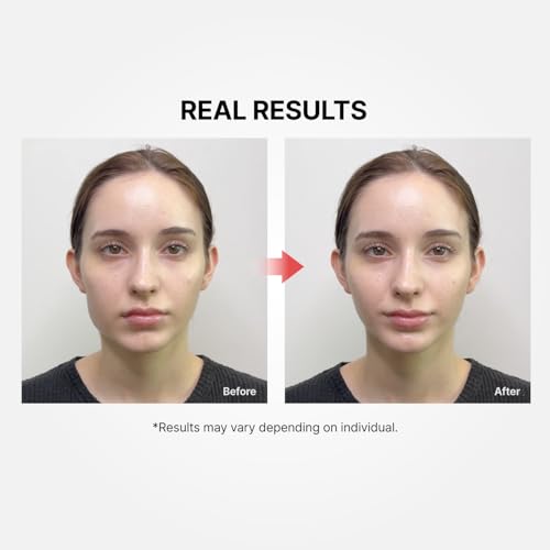 Shumage Gold Seal Lifting Cream+Device