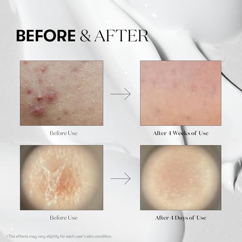 VT COSMETICS CICA Reedle Shot 50, Spicule Microneedling Serum for Pore Care & Exfoliation, Exosome, Centella Asiatica for Glass Skin