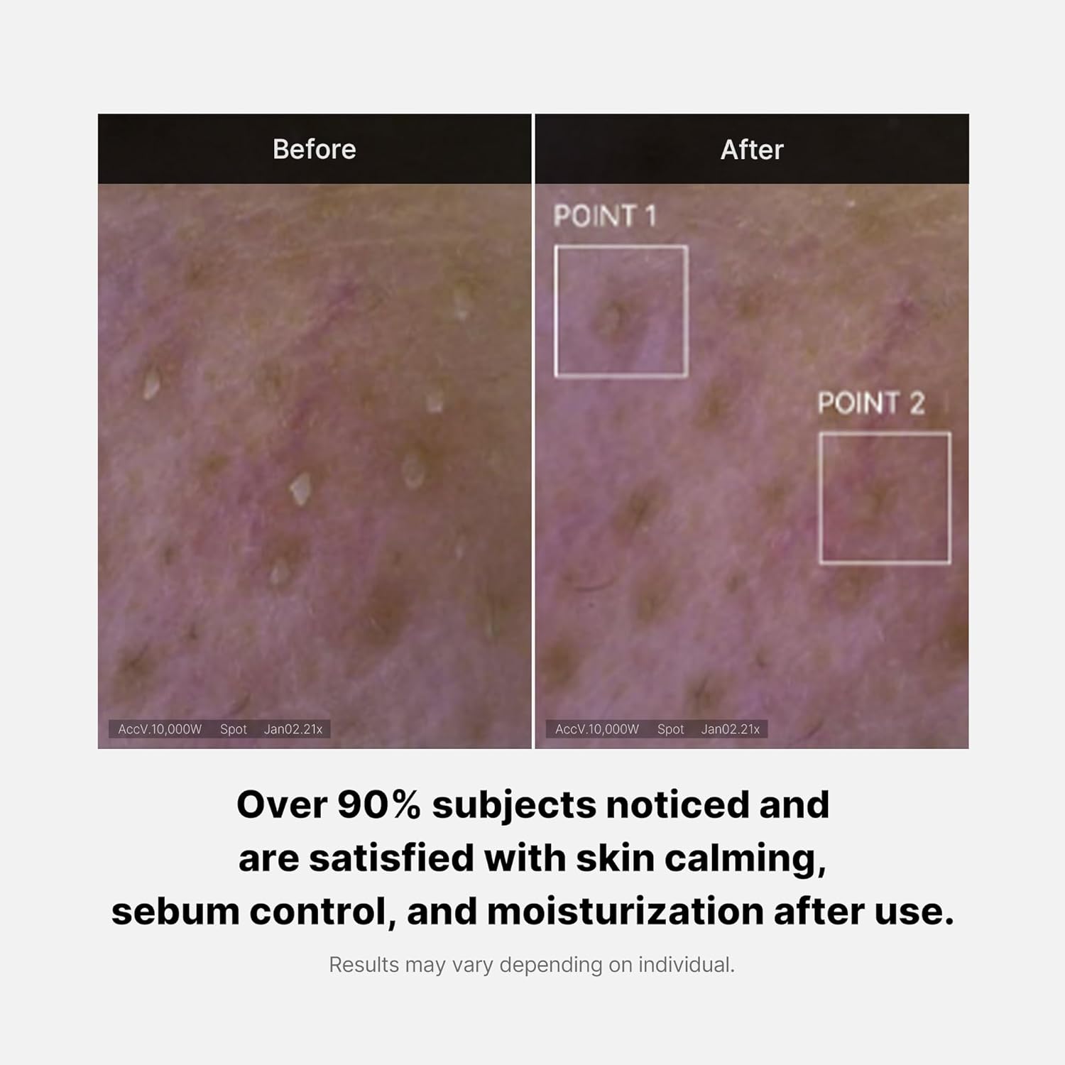 medicube Zero Foam Cleanser for Sensitive Skin