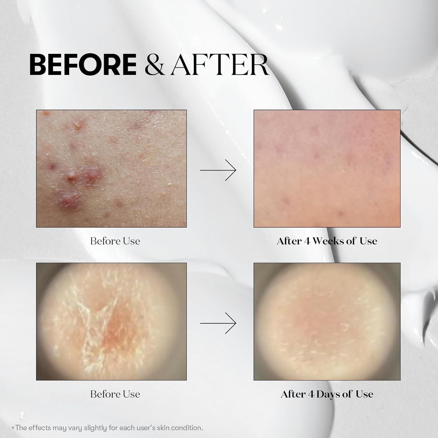 VT COSMETICS CICA Reedle Shot 50, Spicule Microneedling Serum for Pore Care & Exfoliation, Exosome, Centella Asiatica for Glass Skin