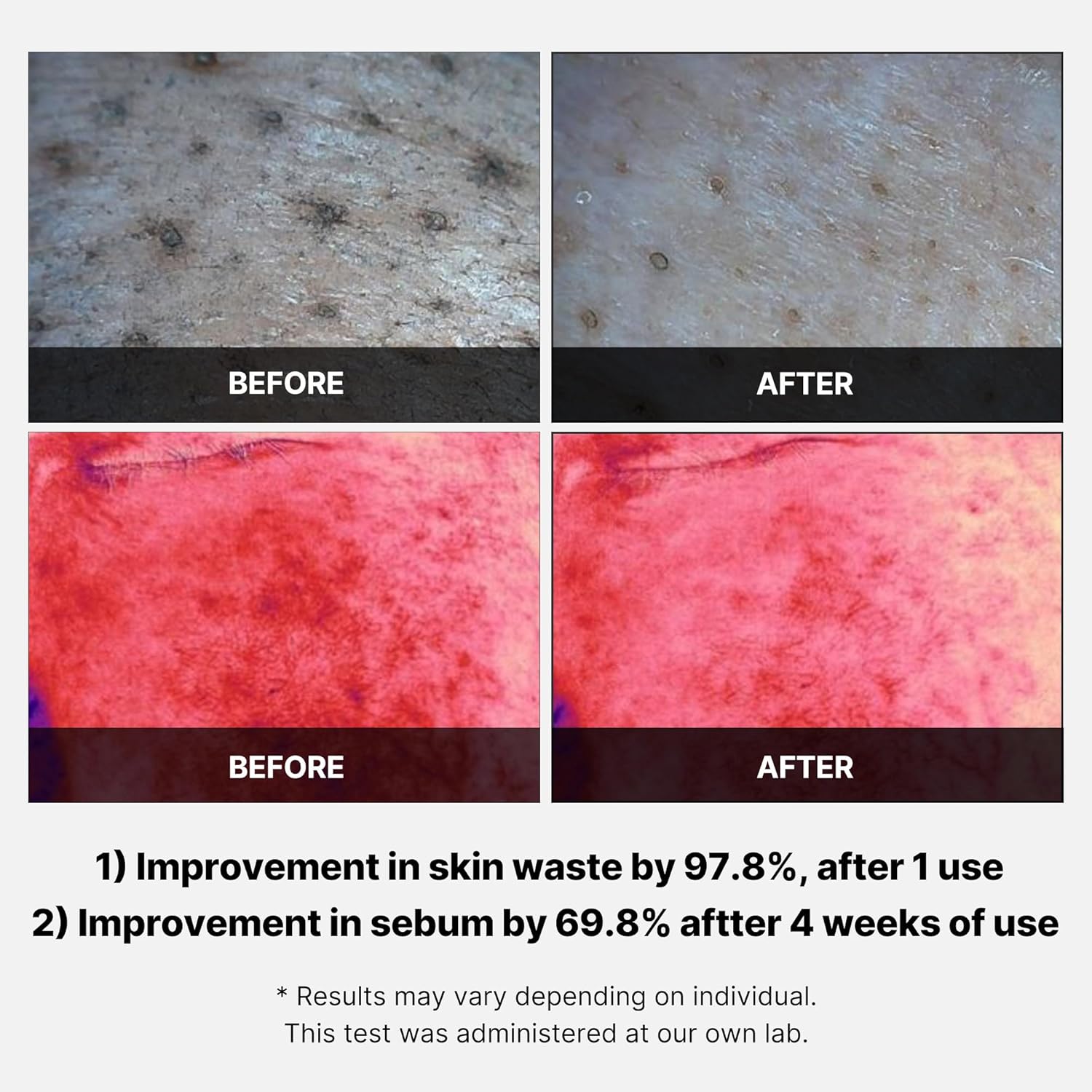 medicube Exosome CICA Tea Tree Calming Toner Pads for Sensitive Skin